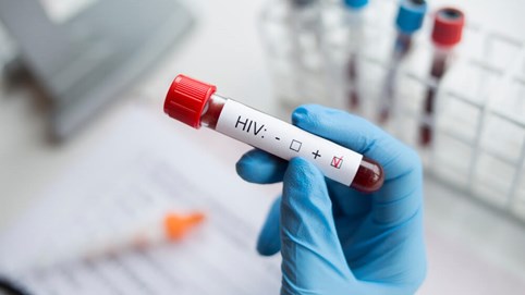 Điều kiện xác định người bị phơi nhiễm với HIV do tai nạn rủi ro nghề nghiệp